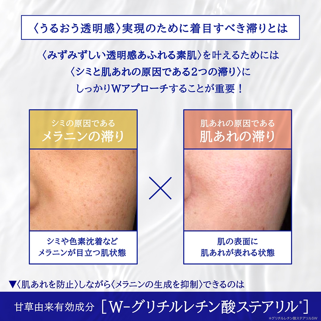 薬用雪肌精 ブライトニング エッセンス ローション [医薬部外品]