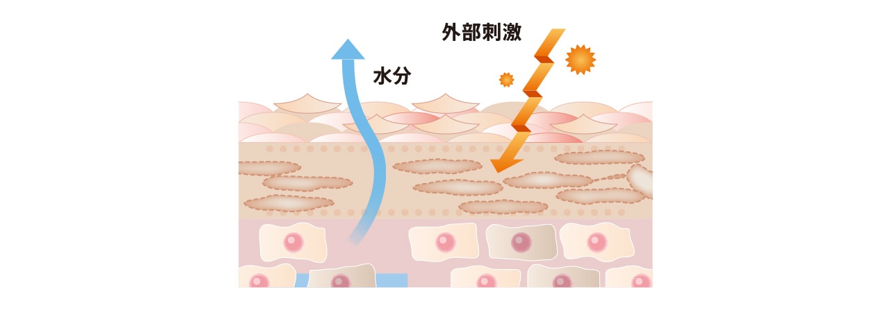 乾燥肌のイメージ
