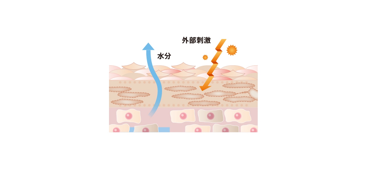 肌あれ・トラブルが起きやすい肌のイメージ